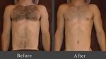 Should Men Shave Their Chest Hair - The new way men are now 